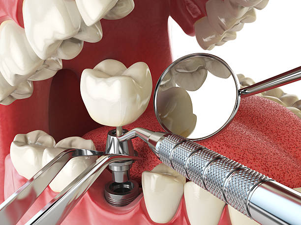 Best Walk-In Emergency Dentist in Stockbridge, GA